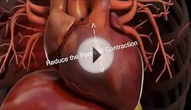 Calcium Channel Blockers - For Nursing Students and Nurses!