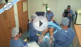 EVLT Endovenous Laser Treatment of Varicose Veins - Live