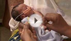 Newborn Care Series: Inserting a Gastric Tube