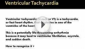 VENTRICULAR TACHYCARDIA (V Tach,VT) Causes,Symptoms